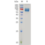 SDS-PAGE - Recombinant Human IFNAR2 Protein (Fc Tag) (A317908) - Antibodies.com