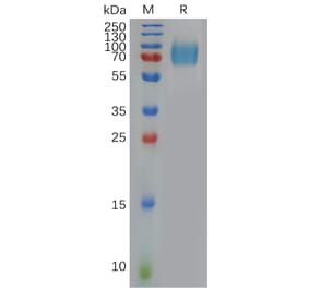 SDS-PAGE - Recombinant Human Interferon alpha/beta Receptor 1 Protein (6×His Tag) (A317909) - Antibodies.com