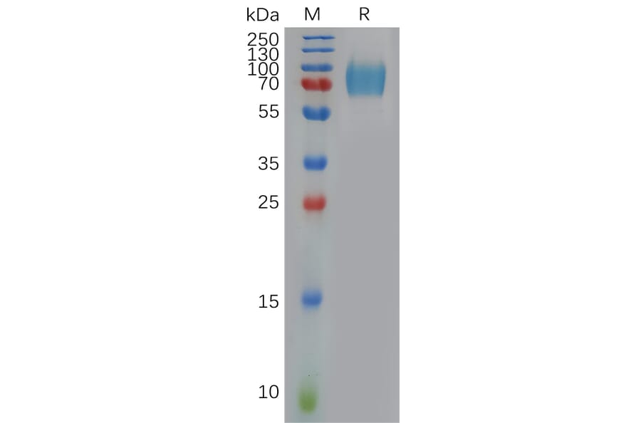 SDS-PAGE - Recombinant Human Interferon alpha/beta Receptor 1 Protein (6×His Tag) (A317909) - Antibodies.com