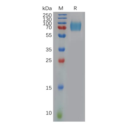SDS-PAGE - Recombinant Human Interferon alpha/beta Receptor 1 Protein (6×His Tag) (A317909) - Antibodies.com