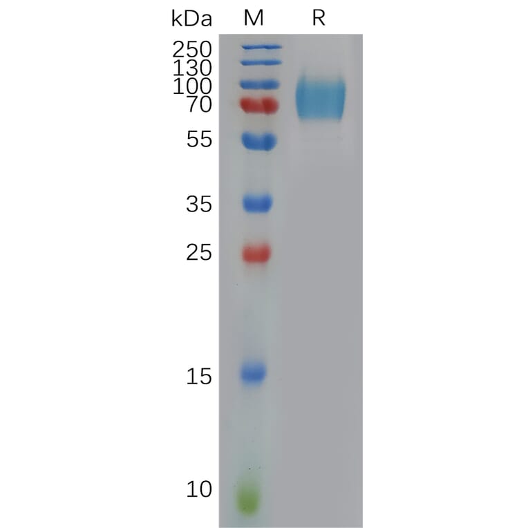 SDS-PAGE - Recombinant Human Interferon alpha/beta Receptor 1 Protein (6×His Tag) (A317909) - Antibodies.com