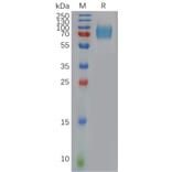 SDS-PAGE - Recombinant Human Interferon alpha/beta Receptor 1 Protein (6×His Tag) (A317909) - Antibodies.com