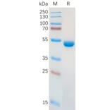 SDS-PAGE - Recombinant Human Galectin 1 Protein (Fc Tag) (A317910) - Antibodies.com