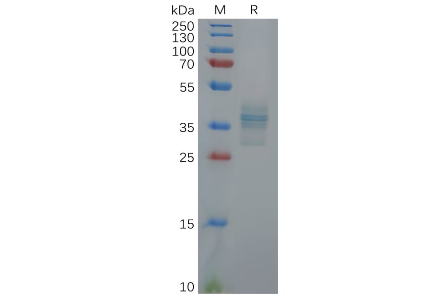 SDS-PAGE - Recombinant Human Gastrin Protein (Fc Tag) (A317911) - Antibodies.com
