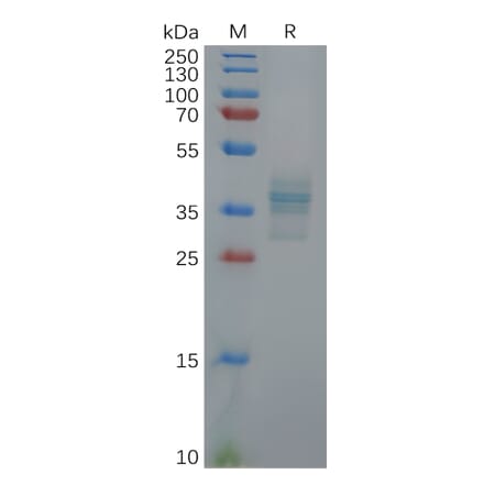 SDS-PAGE - Recombinant Human Gastrin Protein (Fc Tag) (A317911) - Antibodies.com