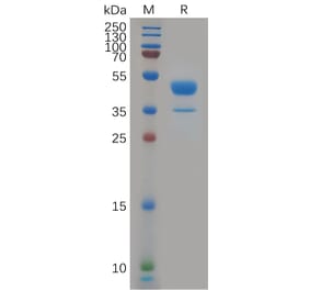 SDS-PAGE - Recombinant Human CXCR2 Protein (Fc Tag) (A317914) - Antibodies.com