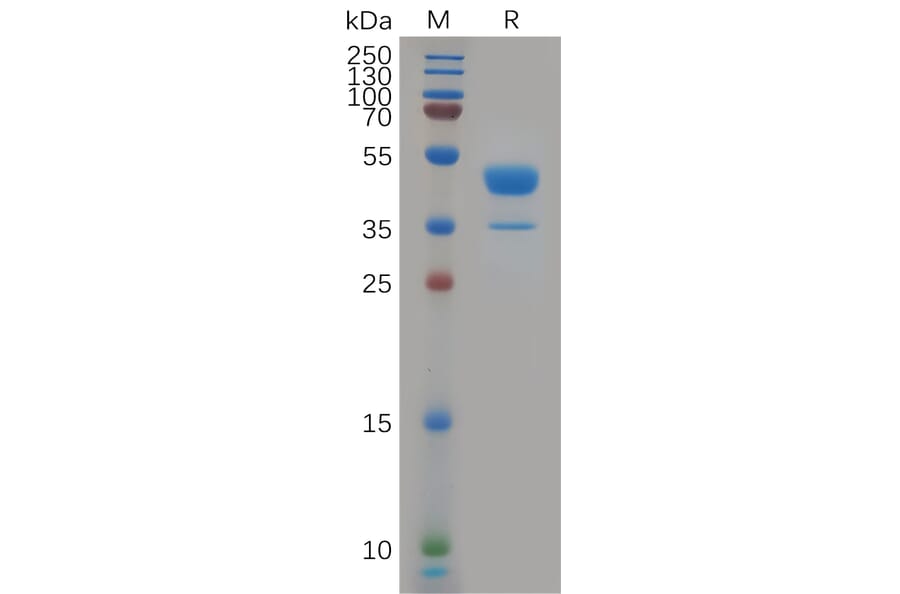 SDS-PAGE - Recombinant Human CXCR2 Protein (Fc Tag) (A317914) - Antibodies.com