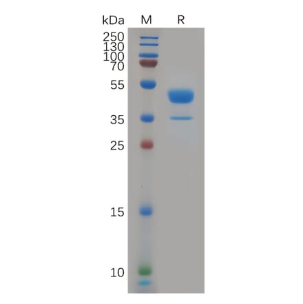 SDS-PAGE - Recombinant Human CXCR2 Protein (Fc Tag) (A317914) - Antibodies.com