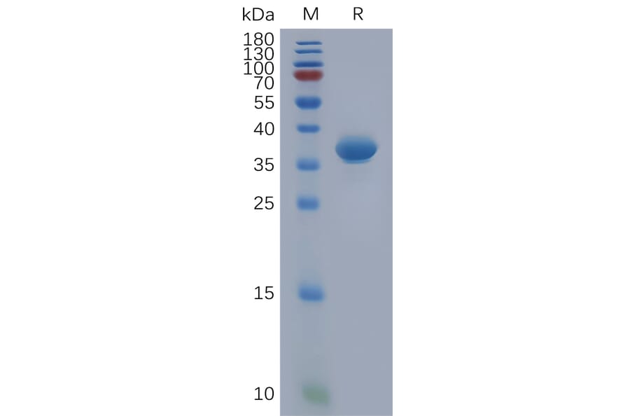 SDS-PAGE - Recombinant Human CXCL1/GRO alpha Protein (Fc Tag) (A317917) - Antibodies.com