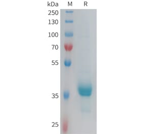 SDS-PAGE - Recombinant Human CX3CR1 Protein (Fc Tag) (A317918) - Antibodies.com