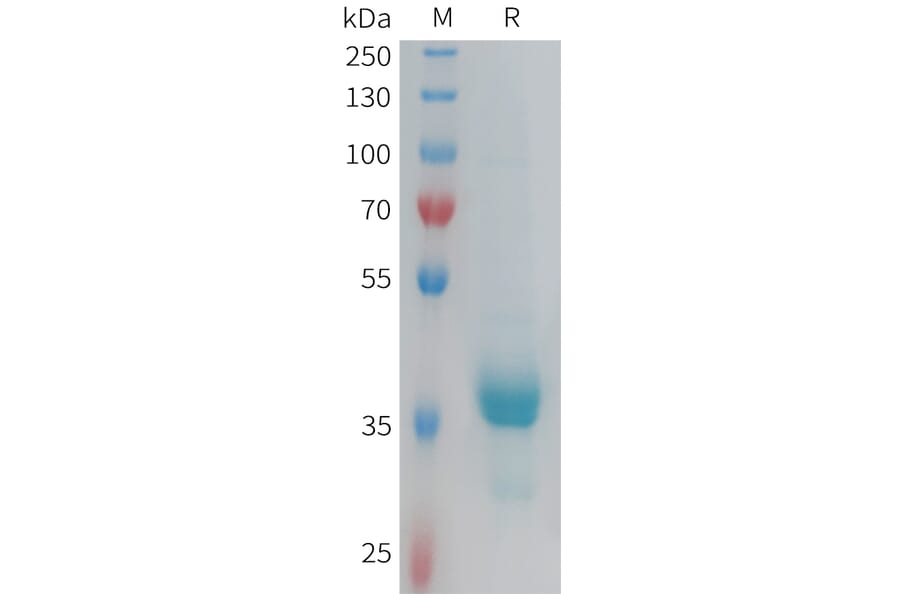SDS-PAGE - Recombinant Human CX3CR1 Protein (Fc Tag) (A317918) - Antibodies.com