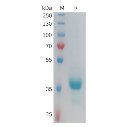 SDS-PAGE - Recombinant Human CX3CR1 Protein (Fc Tag) (A317918) - Antibodies.com