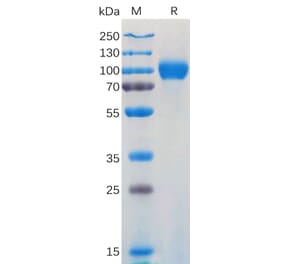 SDS-PAGE - Recombinant Human CD116 Protein (Fc Tag) (A317919) - Antibodies.com