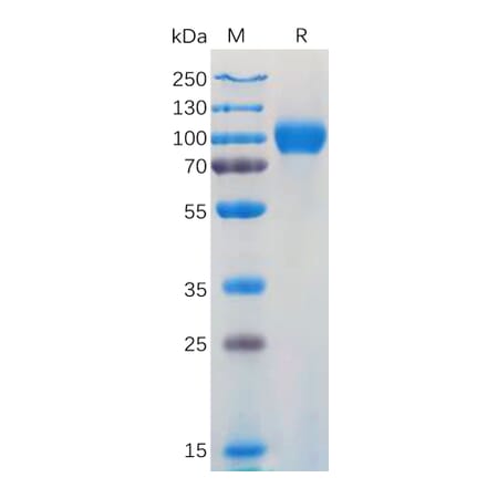 SDS-PAGE - Recombinant Human CD116 Protein (Fc Tag) (A317919) - Antibodies.com