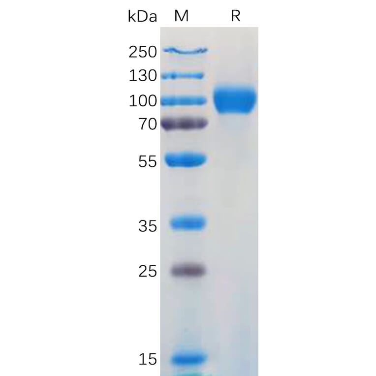 SDS-PAGE - Recombinant Human CD116 Protein (Fc Tag) (A317919) - Antibodies.com