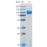 SDS-PAGE - Recombinant Human CD116 Protein (Fc Tag) (A317919) - Antibodies.com