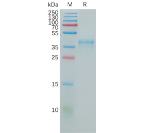 SDS-PAGE - Recombinant Human CCR5 Protein (Fc Tag) (A317920) - Antibodies.com