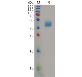 SDS-PAGE - Recombinant Human CCR2 Protein (Fc Tag) (A317921) - Antibodies.com
