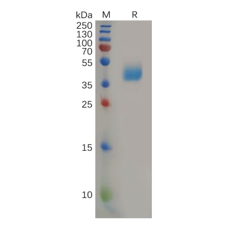 SDS-PAGE - Recombinant Human CCR2 Protein (Fc Tag) (A317921) - Antibodies.com