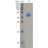 SDS-PAGE - Recombinant Human CCR2 Protein (Fc Tag) (A317921) - Antibodies.com