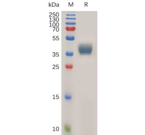 SDS-PAGE - Recombinant Human CCR1 Protein (Fc Tag) (A317922) - Antibodies.com