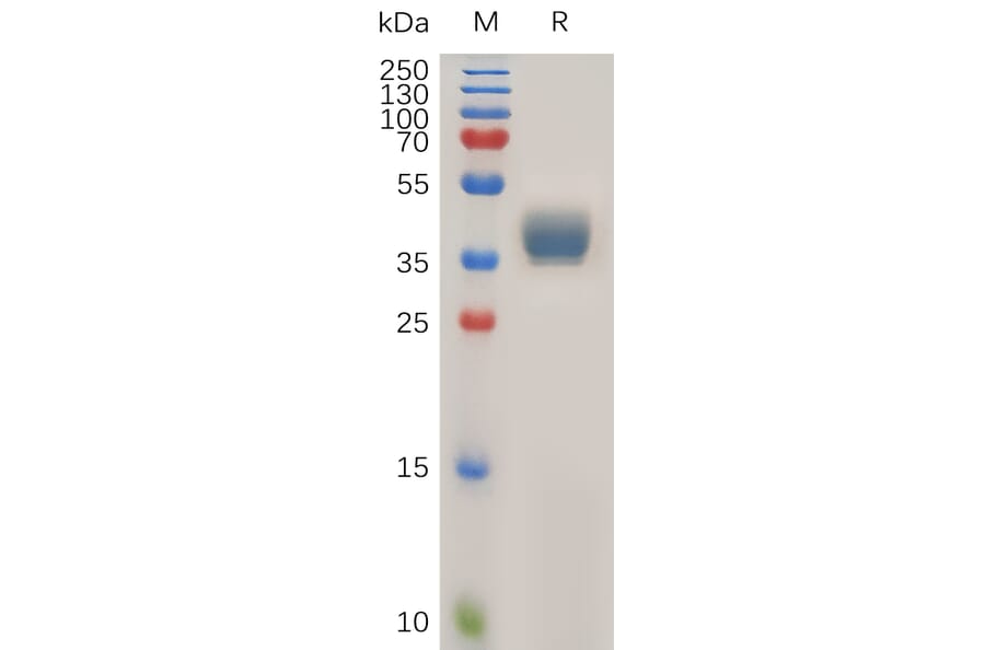 SDS-PAGE - Recombinant Human CCR1 Protein (Fc Tag) (A317922) - Antibodies.com