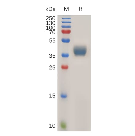 SDS-PAGE - Recombinant Human CCR1 Protein (Fc Tag) (A317922) - Antibodies.com