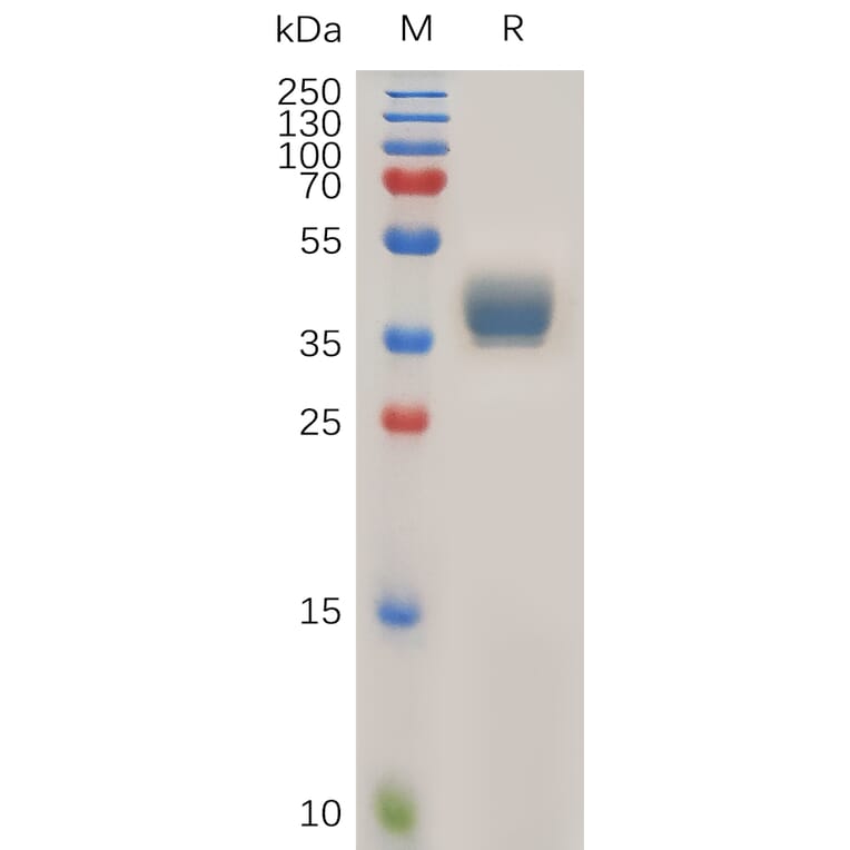 SDS-PAGE - Recombinant Human CCR1 Protein (Fc Tag) (A317922) - Antibodies.com