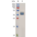 SDS-PAGE - Recombinant Human CCR1 Protein (Fc Tag) (A317922) - Antibodies.com
