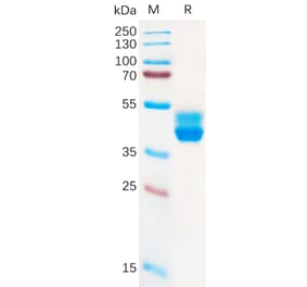 SDS-PAGE - Recombinant Human Cannabinoid Receptor II Protein (Fc Tag) (A317923) - Antibodies.com