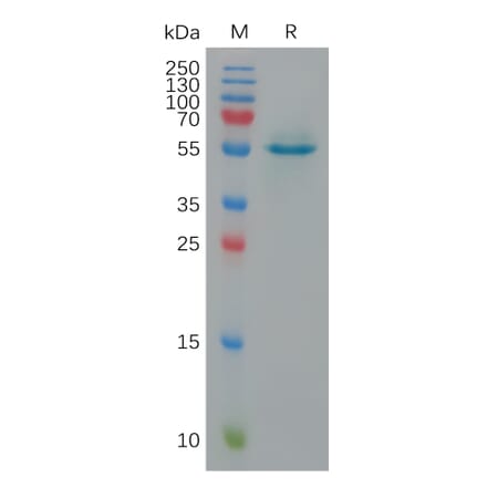 SDS-PAGE - Recombinant Human Calreticulin Protein (6×His Tag) (A317924) - Antibodies.com