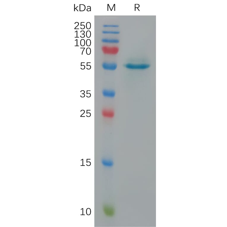 SDS-PAGE - Recombinant Human Calreticulin Protein (6×His Tag) (A317924) - Antibodies.com