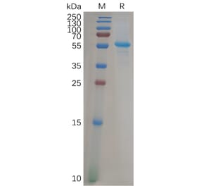 SDS-PAGE - Recombinant Human ADAM9 Protein (6×His Tag) (A317926) - Antibodies.com