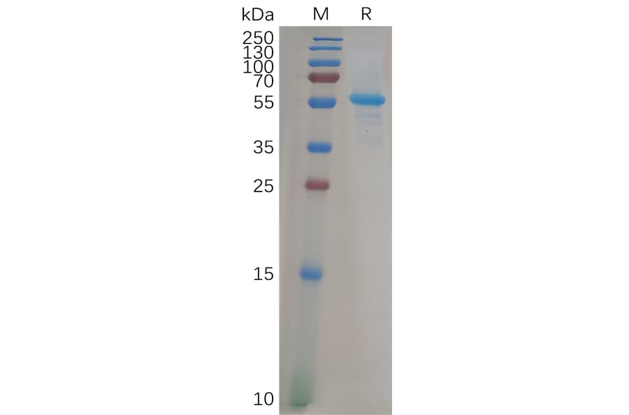 SDS-PAGE - Recombinant Human ADAM9 Protein (6×His Tag) (A317926) - Antibodies.com