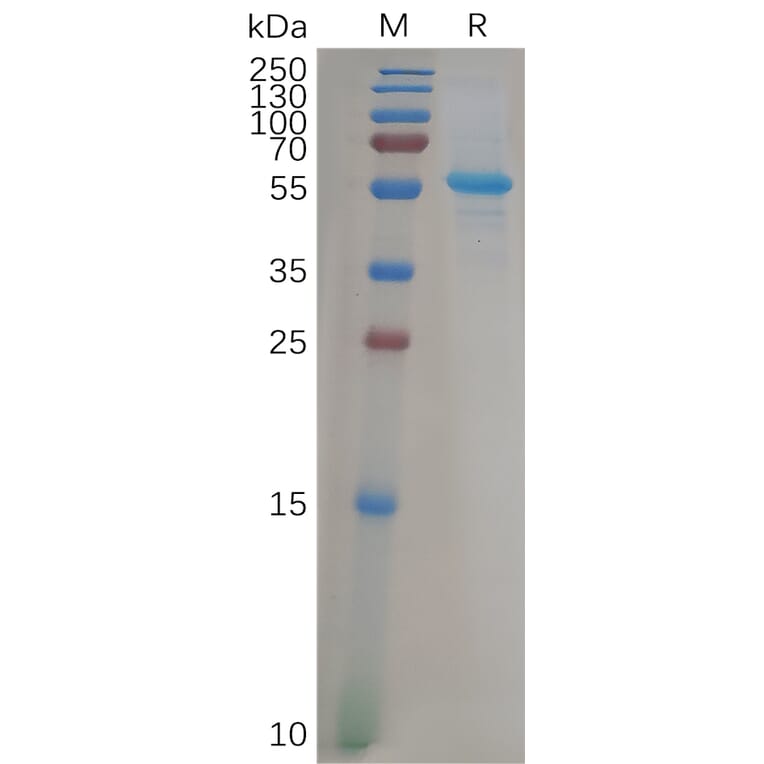 SDS-PAGE - Recombinant Human ADAM9 Protein (6×His Tag) (A317926) - Antibodies.com