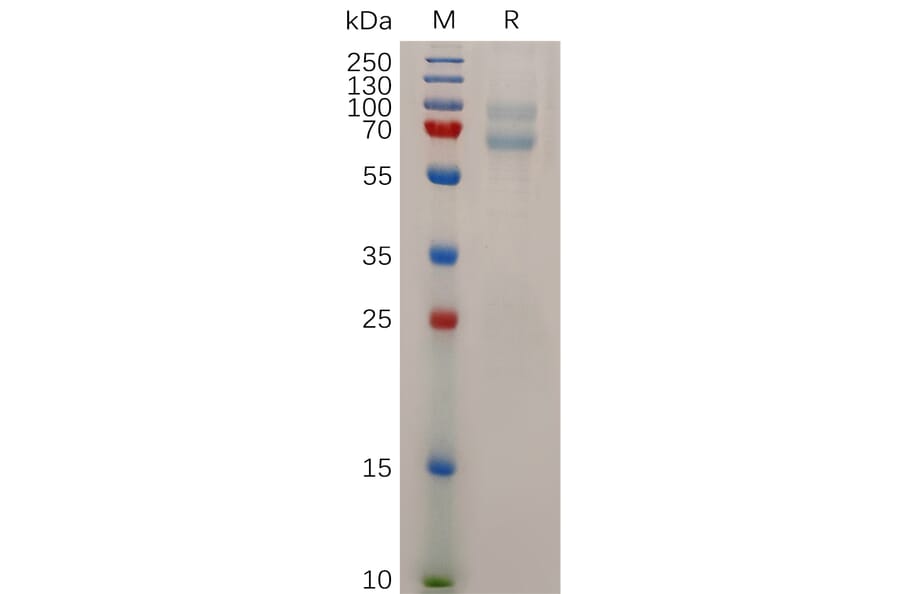 SDS-PAGE - Recombinant Human MAGEA4 Protein (6×His Tag) (A317927) - Antibodies.com