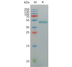 SDS-PAGE - Recombinant Human IL-17A Protein (Fc Tag) (A317930) - Antibodies.com