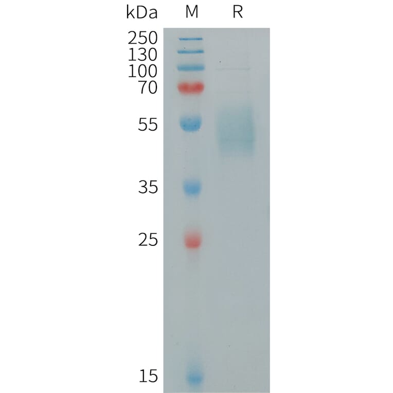 SDS-PAGE - Recombinant Human IL-15 Protein (Fc Tag) (A317931) - Antibodies.com