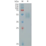SDS-PAGE - Recombinant Human IL-15 Protein (Fc Tag) (A317931) - Antibodies.com