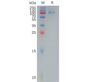 SDS-PAGE - Recombinant Human IL-12RB1 Protein (6×His Tag) (A317932) - Antibodies.com