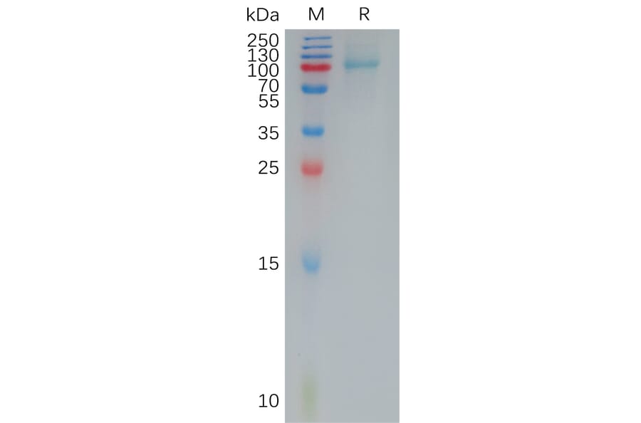 SDS-PAGE - Recombinant Human IL-12RB1 Protein (6×His Tag) (A317932) - Antibodies.com
