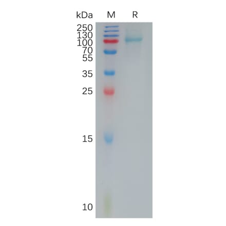 SDS-PAGE - Recombinant Human IL-12RB1 Protein (6×His Tag) (A317932) - Antibodies.com