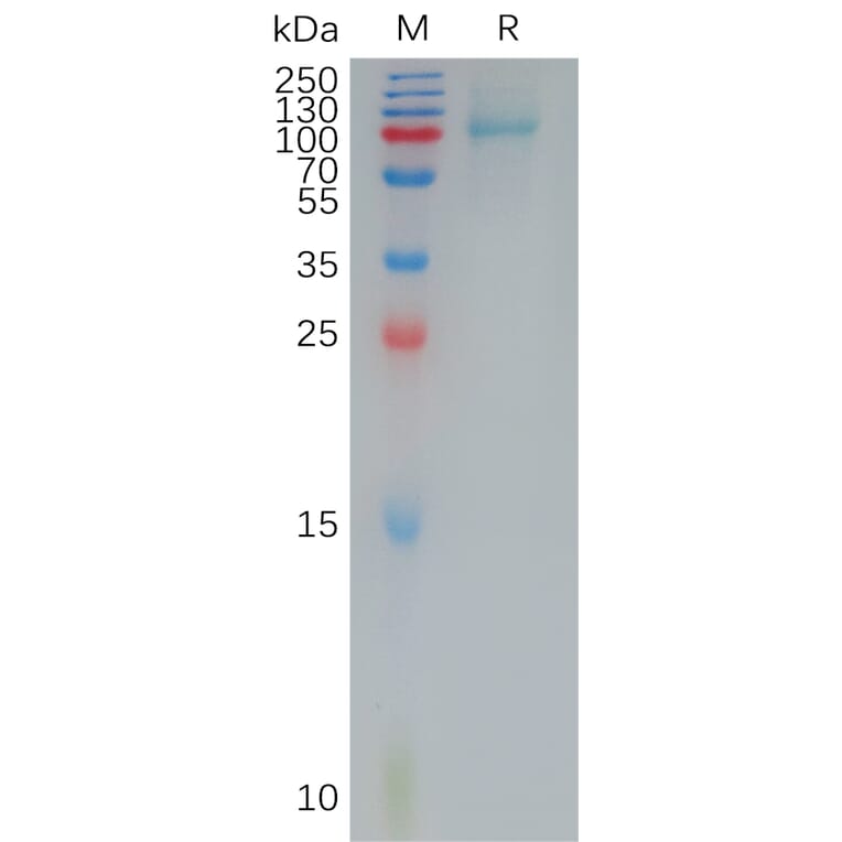 SDS-PAGE - Recombinant Human IL-12RB1 Protein (6×His Tag) (A317932) - Antibodies.com