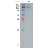 SDS-PAGE - Recombinant Human IL-12RB1 Protein (6×His Tag) (A317932) - Antibodies.com
