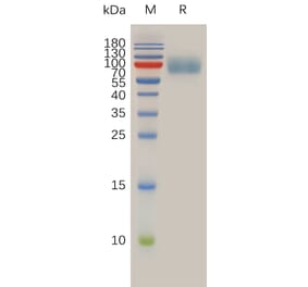 SDS-PAGE - Recombinant Human IL-10RA Protein (Fc Tag) (A317933) - Antibodies.com