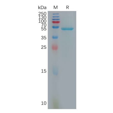 SDS-PAGE - Recombinant Human IL-10 Protein (Fc Tag) (A317934) - Antibodies.com