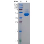 SDS-PAGE - Recombinant Human Nectin 4 Protein (6×His Tag) (A317935) - Antibodies.com