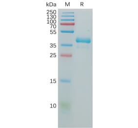 SDS-PAGE - Recombinant Human GnRHR Protein (Fc Tag) (A317937) - Antibodies.com