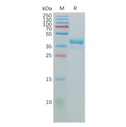 SDS-PAGE - Recombinant Human GnRHR Protein (Fc Tag) (A317937) - Antibodies.com