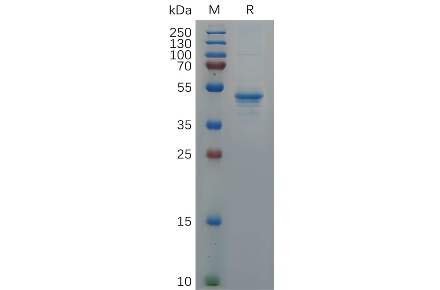 SDS-PAGE - Recombinant Human GDNF Protein (Fc Tag) (A317938) - Antibodies.com